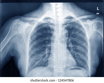vem uppfann röntgen och hur gick det till