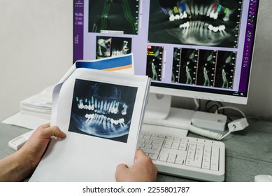 X-ray image on display on a computer screen to patients. Doctor presenting photo with tooth x-ray film recommend patient in treatment of dental and dentistry. Preparation for prosthetic teeth. Closeup - Powered by Shutterstock