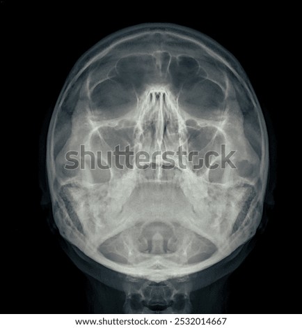 X-ray image of the skull in water's view, displaying clear bone structure with no visible abnormalities.