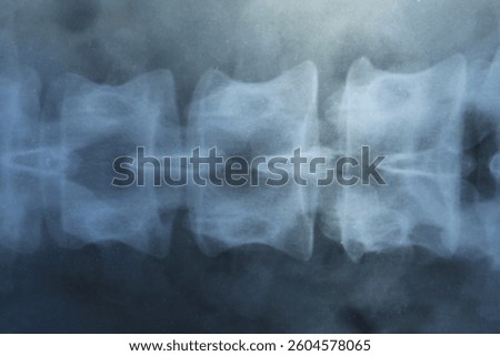 X-ray image of spinal column as background, closeup