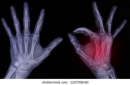 166 Skeleton hand ok Stock Photos, Images & Photography | Shutterstock