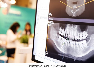 X-ray of the jaw with teeth on a computer monitor. Examination of the oral cavity using digital, medical equipment. Dental treatment in a dental clinic.