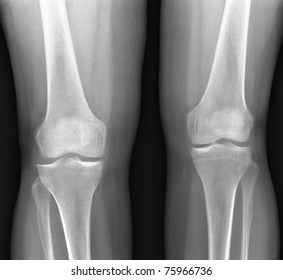 Xray Knees Many Others Xray Images Stock Photo 75966736 | Shutterstock