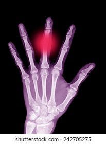 Xray Left Hand Stock Photo 242705275 | Shutterstock