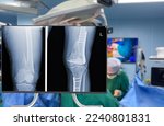 x-ray of leg and knee. Blurry Traumatology orthopedic surgery hospital emergency operating room for the leg broken operation. Medical health and Education concept. 