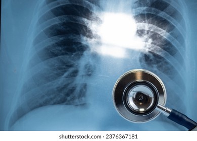 Xray of lung and stethoscope,Lung care diagnosis of pulmonary concept