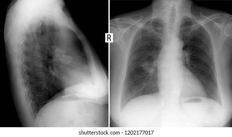 267 Bullet x ray Images, Stock Photos & Vectors | Shutterstock