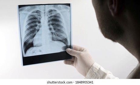 Doctor Looking Xray Lungs Clinic Medical Stock Photo 1908073477 ...