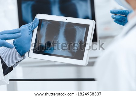 x-ray of the lungs on the screen of a digital tablet.