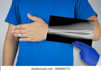 X-ray of a man's forearm. A photograph of the spoke-bone and ulna bones is brought to the patient's hand. Radiologist examine X-ray examination. - Shutterstock ID 1800003772