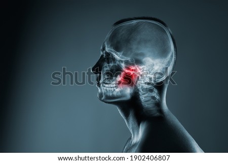 X-ray of a man's head. Medical examination of head injuries. Jaw joint is highlighted by red colour. Others x-ray images in my portfolio.