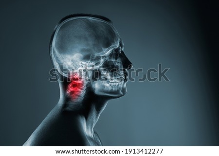 X-ray of a man's head. Medical examination of head injuries.