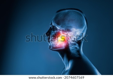 X-ray of a man's head on blue background. Medical examination of head injuries. Jaw joint is highlighted by yellow red colour. Others x-ray images in my portfolio.