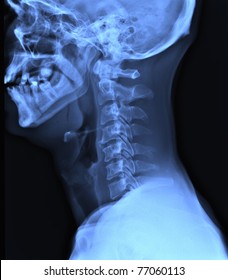 x-ray of the neck  / Many others X-ray images in my portfolio.