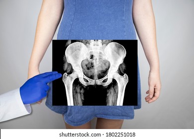 Röntgenaufnahme der Beckenknochen einer Frau. Ein Radiologe des Arztes studiert eine Röntgenuntersuchung. Ein Hüftgelenk wird auf den Körper des Patienten gelegt