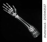 X-ray photograph of human arm bones