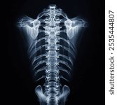 X-ray photograph of the human spine and scapula