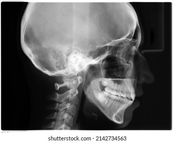 6,125 Lateral skull anatomy Images, Stock Photos & Vectors | Shutterstock