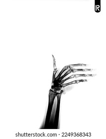 X-ray right hand  ( anterior-posterior ) ( front view ) - Shutterstock ID 2249368343