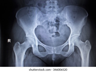 X Ray Spine Pelvis Many Others Stock Photo 124547791 | Shutterstock