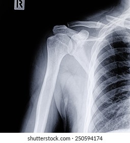 Clavicle Bone Images, Stock Photos & Vectors | Shutterstock