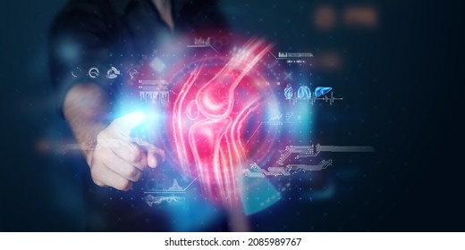 X-ray Of A Sore Knee, Hologram Of Joints, Structure Of The Knee. X-ray Image, Trauma, Rheumatologist Consultation, Skeletal Image, Medicine Of The Future