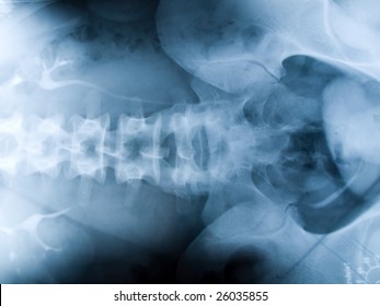 Xray Spine Human