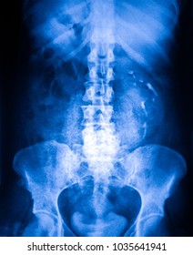 Xray Of Stomach And Pelvis Section