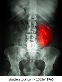 Xray Of Stomach And Pelvis Section