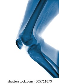 X ray leg Images, Stock Photos & Vectors | Shutterstock