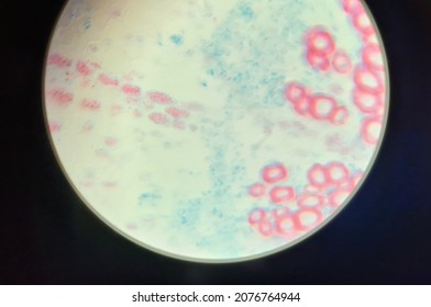 Xylem And Phloem Of Parsley Root Under Microscope