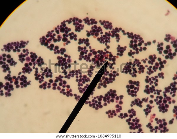 candida albicans under microscope