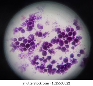 Yeast Budding Yeast Cells Cgaracteristcis Cryptococcal Stock Photo ...