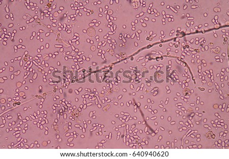 yeast cells