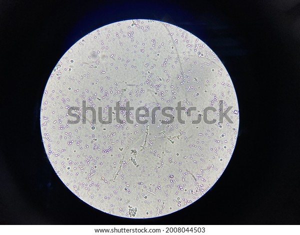 Yeast Cells Budding Yeast Cells Pseudohyphae Stock Photo Shutterstock