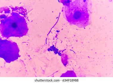 Yeast Cells With Epithelial Tissue In Gram Stain Method.