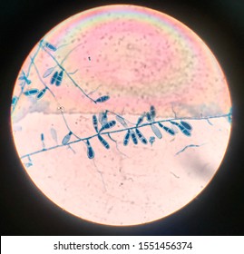 Yeast Cells Find With Microscope.