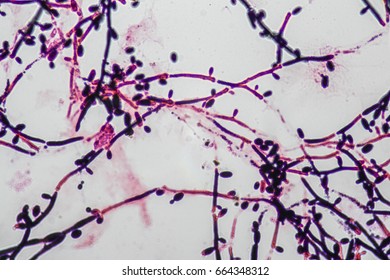 79 Fungus sputum Images, Stock Photos & Vectors | Shutterstock