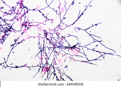 Yeast Cells And Pseudohyphae Yeast Cells (Fungus)