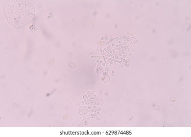 urine yeast