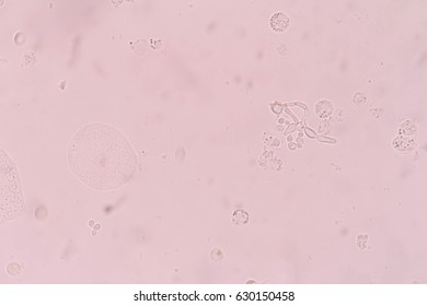 urine cells