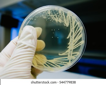 Yeast cultivation on agar medium plate in microbiology laboratory