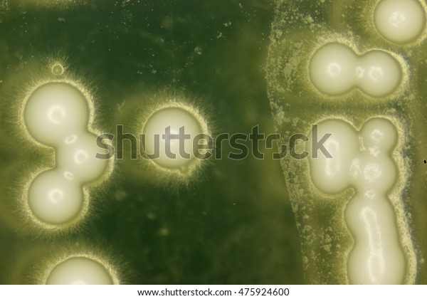 Yeast under the\
microscope