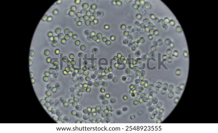 Yeast under the microscope, used for baking bread.
