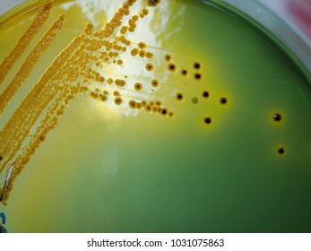 160 Bile salt Stock Photos, Images & Photography | Shutterstock