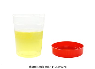 Yellow Color Is Normal Urine Sample In Sterile Plastic Container With Red Lid Isolated On White Background For Determined By Urine Test Strip Or Dipstick Test In Lab