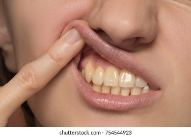 Yellowing Teeth Images Stock Photos Vectors Shutterstock