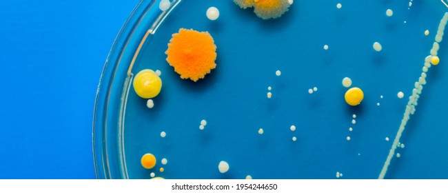 Yellow and orange Bacterial colonies on agar agar substrate in petri dish plate on blue background - Shutterstock ID 1954244650