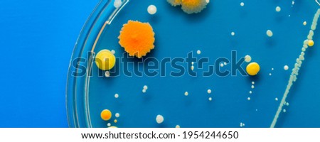Yellow and orange Bacterial colonies on agar agar substrate in petri dish plate on blue background
