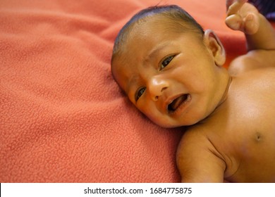 A Yellow Skin Colored Neonatal Jaundice Baby Crying In Pain